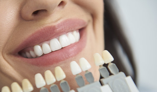 scale and polish, tooth whitening, Jersey, St Helier